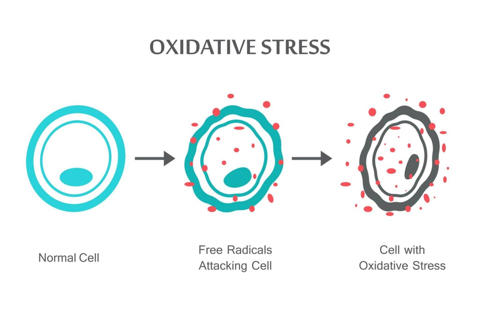 oxidative stress